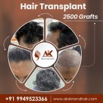 Say Goodbye to Baldness with Our Skilled Hair Transplant Expert