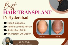 Best Hair Transplant Surgeon – Restore Your Confidence Today!