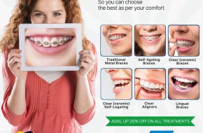 Best Dental Hospital in Secunderabad for Braces Treatment