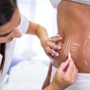 Body Contouring Surgery at Medicover Hospitals: Reshape Your Confidence