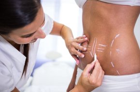 Body Contouring Surgery at Medicover Hospitals: Reshape Your Confidence