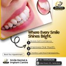 How a Bright Smile Can Boost Your Confidence | Smile Dental and Implant Centre