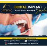 Dental Implant Cost in Hyderabad 2026 | Smile Dental and Implant Centre