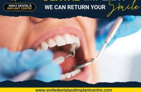 Dental Implant Cost in Hyderabad 2026 | Smile Dental and Implant Centre