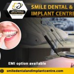 Dental Clinic near Dammaiguda, Nagaram Secunderabad – Complete Dental Care for Your Smile