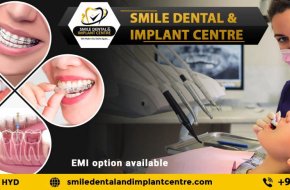Dental Clinic near Dammaiguda, Nagaram Secunderabad – Complete Dental Care for Your Smile