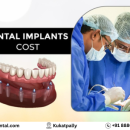 Best Dental Implant Treatment in Kukatpally – Affordable Cost at FMS Dental