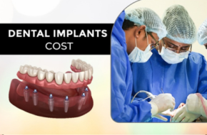 Best Dental Implant Treatment in Kukatpally – Affordable Cost at FMS Dental