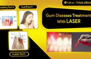 Effective Gum Disease Treatment for Healthy Teeth and Gums