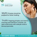 Fade Dark Spots with Expert Pigmentation Treatment in Secunderabad!