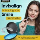 Invisalign near Me Cost – Affordable Clear Aligners for a Perfect Smile