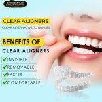 Best Dental Hospital in Secunderabad for Invisalign Treatment