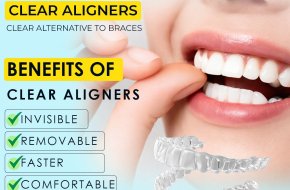 Best Dental Hospital in Secunderabad for Invisalign Treatment