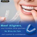 Invisible Braces in Sainikpuri – A Modern Way to Straighten Your Smile in Secunderabad.