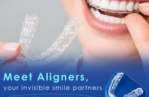 Invisible Braces in Sainikpuri – A Modern Way to Straighten Your Smile in Secunderabad.