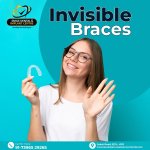 How Invisible Braces Fix Crooked Teeth in As Rao Nagar