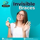 Straighten Your Teeth Invisibly in AS Rao Nagar | Invisalign Experts