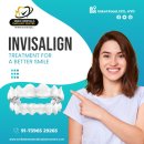 Top Rated Invisalign Near Me | Smile Dental Hyderabad Reviews