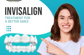 Top Rated Invisalign Near Me | Smile Dental Hyderabad Reviews