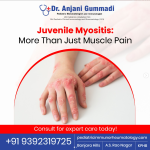 Juvenile Arthritis in Kids: Key Signs to Know | Pediatric Expert in Hyderabad
