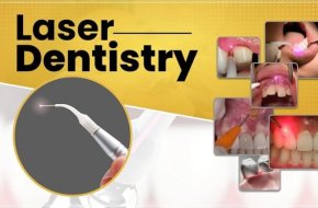 Laser Dental Clinic in Hyderabad, Telangana