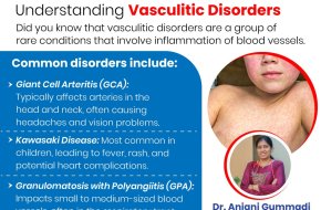 Connective Tissue & Vasculitic Disorders