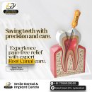 Best Root Canal Dental Clinic in AS Rao Nagar, Secunderabad.