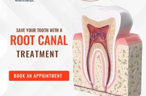 What is the minimum cost for root canal treatment in Sainikpuri?