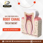 Leading Dental Clinic for Root Canal Treatment in AS Rao Nagar, Secunderabad