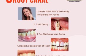 Root Canal Treatment Benefits | Painless Root Canal Treatment in AS Rao Nagar