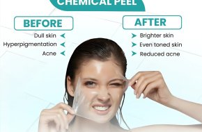Get Radiant Skin with Advanced Pigmentation Treatment in Secunderabad
