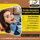 Top Dental Clinic in Secunderabad: Smile Dental & Implant Centre
