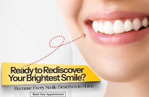 How much is the Price for Cleaning Teeth? | Dental Doctor near Me