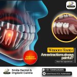 Painless Wisdom Tooth Extraction in AS Rao Nagar at Smile Dental and Implant Centre