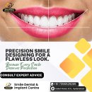 Precision Smile Designing at Smile Dental and Implant Centre in Secunderabad