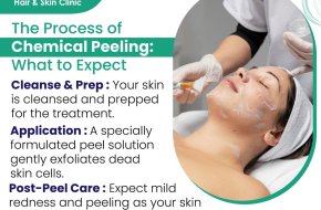 Skin Treatment in Hyderabad for Pigmentation: Should You Choose Laser or Peels?