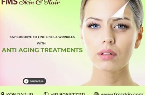 Best Skin Specialist in Hyderabad | FMS Skin and Hair Clinic