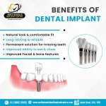 Affordable Dental Implants in Sainikpuri, Secunderabad