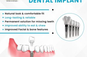 Affordable Dental Implants in Sainikpuri, Secunderabad