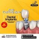 Budget-Friendly Ways to Get Implants in 2025