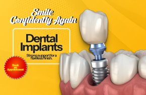 Budget-Friendly Ways to Get Implants in 2025