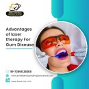 Laser Flap Surgery cost in Hyderabad | Smile Dental and Implant Centre