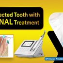 Best Root Canal Treatment Clinic Near Kapra, Secunderabad