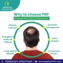 Regrow Your Hair Naturally with PRP Treatment by a Hair Specialist in Hyderabad
