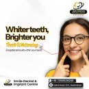 Achieve a Brighter Smile with Teeth Whitening at Smile Dental and Implant Centre