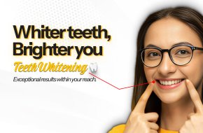 Achieve a Brighter Smile with Teeth Whitening at Smile Dental and Implant Centre